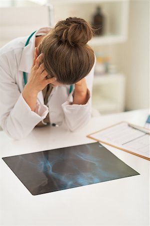 Stressed doctor woman with fluorography Stock Photo - Budget Royalty-Free & Subscription, Code: 400-07748411