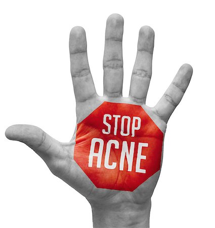 pimple - Stop Acne Sign Painted, Open Hand Raised, Isolated on White Background. Stock Photo - Budget Royalty-Free & Subscription, Code: 400-07840025