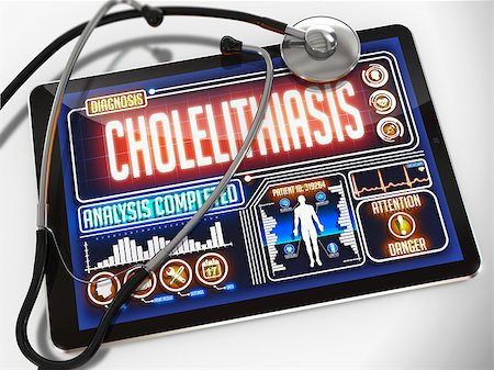 Cholelithiasis - Diagnosis on the Display of Medical Tablet and a Black Stethoscope on White Background. Stock Photo - Budget Royalty-Free & Subscription, Code: 400-07996272