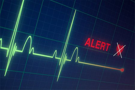 emergency room heart attack - Flat line alert on a heart monitor. Stock Photo - Budget Royalty-Free & Subscription, Code: 400-08074069