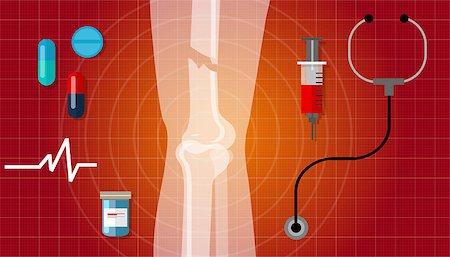 simsearch:400-06394180,k - bone fracture broken legs human anatomy x ray medical treatment illustration icon vector Stock Photo - Budget Royalty-Free & Subscription, Code: 400-08336692