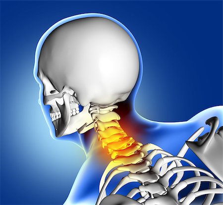 3D render of a blue medical image of close up of bones in the neck Stock Photo - Budget Royalty-Free & Subscription, Code: 400-08649949