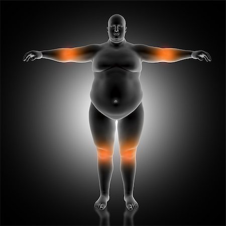 fat man exercising - 3D render of a medical background of overweight male with elbow and knees highlighted Stock Photo - Budget Royalty-Free & Subscription, Code: 400-09114972