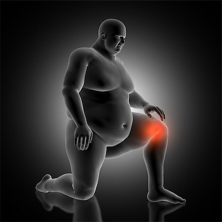 fat man exercising - 3D render of a medical background with overweight male figure holding his knee in pain Stock Photo - Budget Royalty-Free & Subscription, Code: 400-09120906