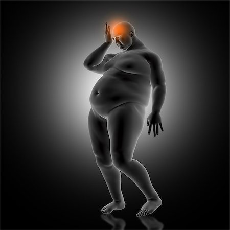 fat man exercising - 3D render of a medical background with overweight male holding head in pain Stock Photo - Budget Royalty-Free & Subscription, Code: 400-09120907