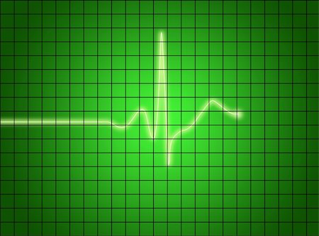 simsearch:400-07222508,k - ekg signal on green screen. medical osciloscope screen. Photographie de stock - Aubaine LD & Abonnement, Code: 400-03995081
