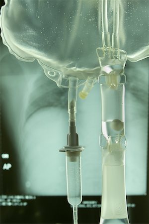 dehydrated - IV Drip Bag and X-Ray Stock Photo - Premium Royalty-Free, Code: 600-00947810
