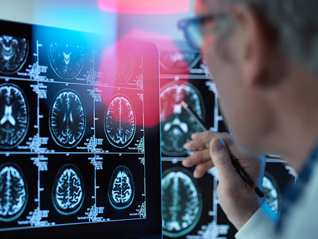 Doctor viewing brain scans for possible disease or damage in clinic Stock Photo - Premium Royalty-Free, Code: 614-09258810