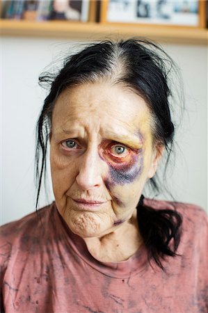 Portrait of senior woman with bruises on her face Stock Photo - Premium Royalty-Free, Code: 6102-08000746