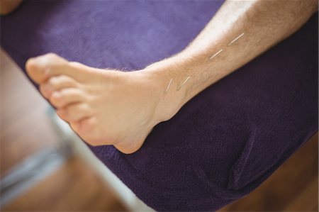 relieved - Patient getting dry needling on leg Stock Photo - Premium Royalty-Free, Code: 6109-08829778