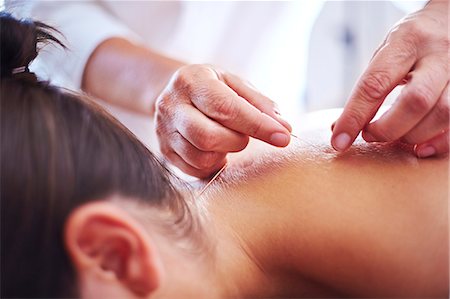 Close up acupuncturist applying acupuncture needles to woman's neck Stock Photo - Premium Royalty-Free, Code: 6113-08105482