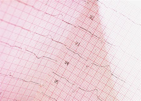 Close-up of an electro cardiogram report Stock Photo - Premium Royalty-Free, Code: 628-02062774