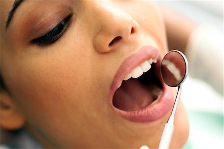 dentistry - Closeup of patient's face at dentist Stock Photo - Premium Royalty-Free, Code: 644-03659548