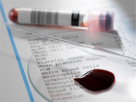 simsearch:649-07279799,k - Blood sample with results of clinical analysis of the blood component Stock Photo - Premium Royalty-Free, Code: 649-07279696