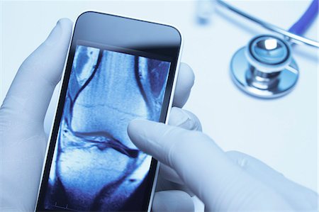 Technology use in healthcare. Doctors hands using smartphone displaying an Xray CT scan of knee Stock Photo - Premium Royalty-Free, Code: 649-07905074
