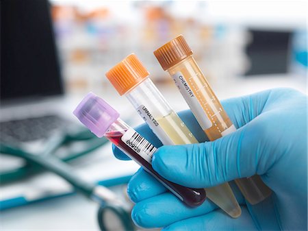 Human samples including blood, urine and chemistry being collected for testing Stock Photo - Premium Royalty-Free, Code: 649-08380954