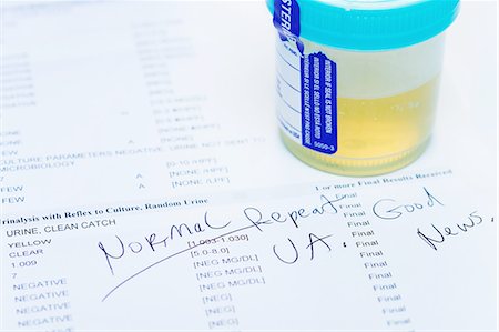 simsearch:649-07279799,k - Studio shot of urine sample on test printout showing normal results. Testing is done as part of yearly health checkup Stock Photo - Premium Royalty-Free, Code: 649-08381730