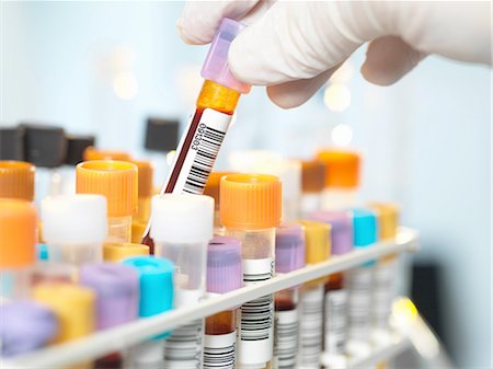 simsearch:649-07279799,k - Laboratory technician preparing blood sample for medical testing in laboratory Stock Photo - Premium Royalty-Free, Code: 649-08479874