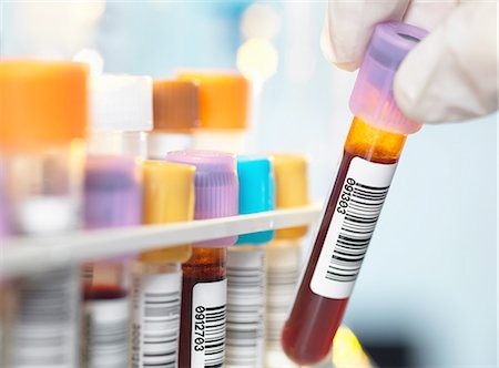 simsearch:649-07279799,k - Laboratory technician preparing blood sample for medical testing in laboratory Stock Photo - Premium Royalty-Free, Code: 649-08479872