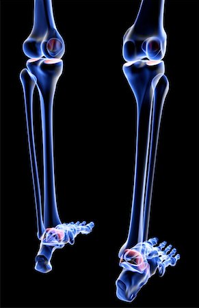 The bones of the leg Stock Photo - Premium Royalty-Free, Code: 671-02095985