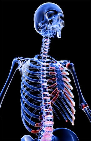 rib cage xray - The bones of the upper body Stock Photo - Premium Royalty-Free, Code: 671-02096091