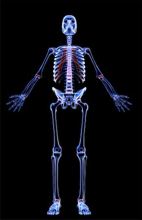 rib cage xray - The skeletal system Stock Photo - Premium Royalty-Free, Code: 671-02096395