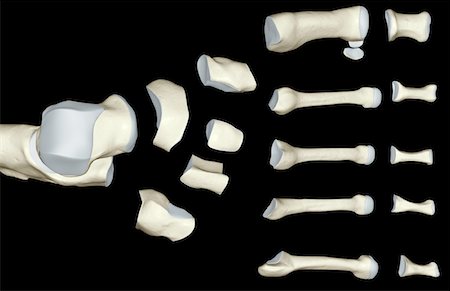 simsearch:671-02093214,k - The bones of the foot Stock Photo - Premium Royalty-Free, Code: 671-02098572