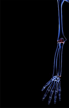 radius - The bones of the upper limb Stock Photo - Premium Royalty-Free, Code: 671-02093885