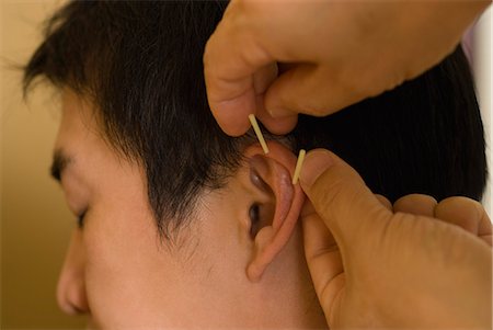 Doctor putting acupuncture needles on patient's ear Stock Photo - Premium Royalty-Free, Code: 685-02941877