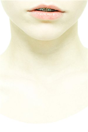 Teenage girl with braces, extreme close-up of lower face and neck Stock Photo - Premium Royalty-Free, Code: 695-05765669