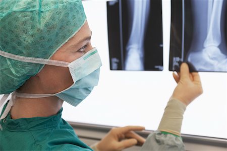 shoulder xray - Radiologist Examining X-Ray of leg, close up Stock Photo - Premium Royalty-Free, Code: 693-03303187