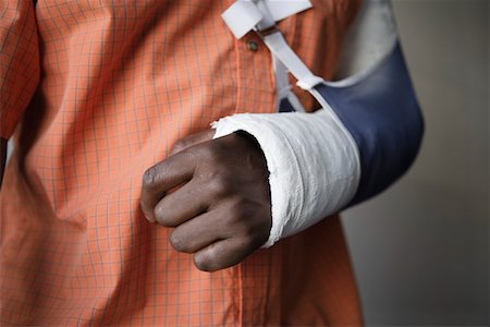 Man with broken arm, close-up of cast Stock Photo - Premium Royalty-Free, Code: 693-03314495