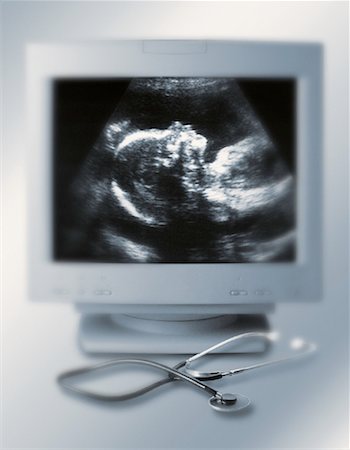 Ultrasound Image on Computer Monitor with Stethoscope Stock Photo - Rights-Managed, Code: 700-00051425