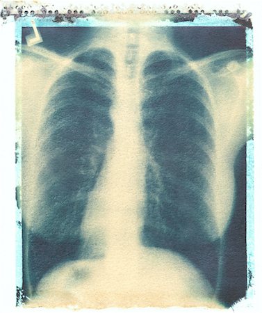 X-Ray Stock Photo - Rights-Managed, Code: 700-00097709