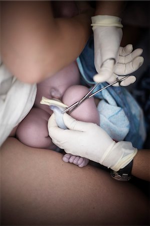 Coupe du cordon ombilical lors de l'accouchement naturel Photographie de stock - Rights-Managed, Code: 700-03484966