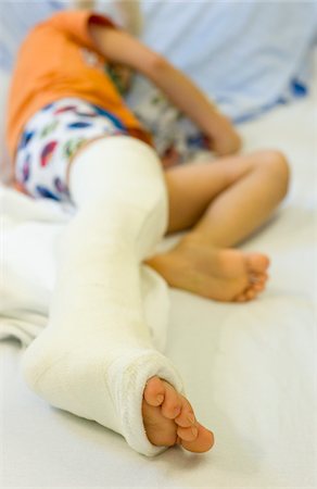 simsearch:600-03230190,k - Boy with Cast on Leg in Hospital Fotografie stock - Rights-Managed, Codice: 700-03777794