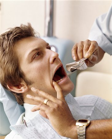 1970s MAN PATIENT OPEN MOUTH DENTIST HAND HOLDING TOOLS Stock Photo - Rights-Managed, Code: 846-02794820