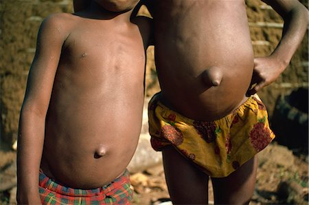 Protruding navels, much admired, are tied long deliberately, Adjoukrou boys, Nazareth, Lagune Ebrie, Ivory Coast, West Africa, Africa Stock Photo - Rights-Managed, Code: 841-02901458