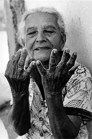 slums - An old woman counts out her age on her fingers. She is outside her home in the favela 'Paraisopolis' in Sao Paulo,Brazil. Stock Photo - Rights-Managed, Code: 862-03436943