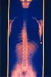 Radiographie du torse de l'homme