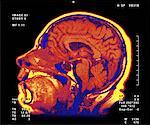 Scanner du cerveau M.R.I.
