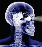 X-Ray of Skeleton with Electronic Eye and Brain