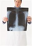 Doctor Holding Chest X-Ray