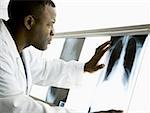 Male doctor looking at chest x- rays