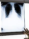 Chest x-ray with male hand