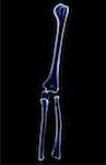 The bones of the upper limb