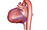 The coronary vessels of the heart