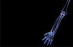 The bones of the upper limb