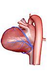 The coronary vessels of the heart