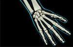 Die Knochen der hand
